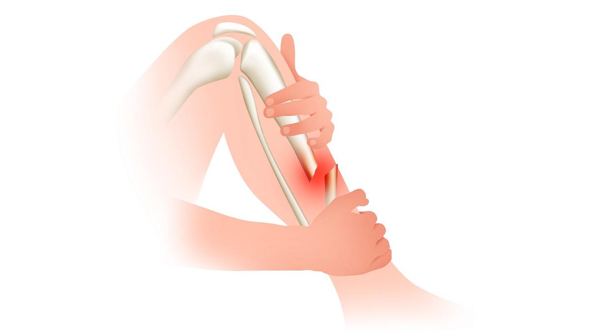 Ndihma e parë: Frakturë e hapur