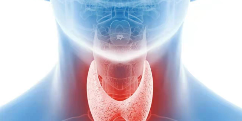 E06  Tiroiditi (Thyreoiditis)