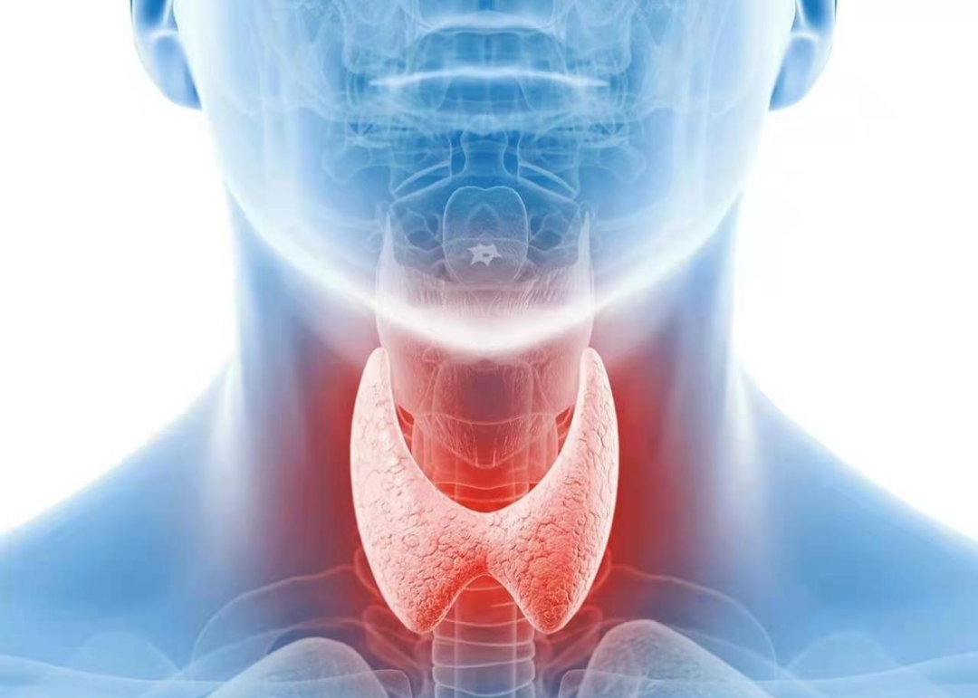 E06  Tiroiditi (Thyreoiditis)