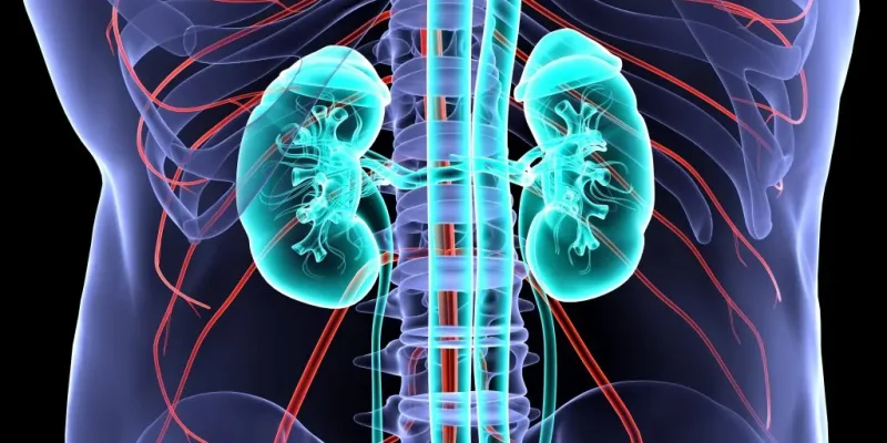 N00  Акутен нефритичен синдром (Syndroma nephriticum acutum)