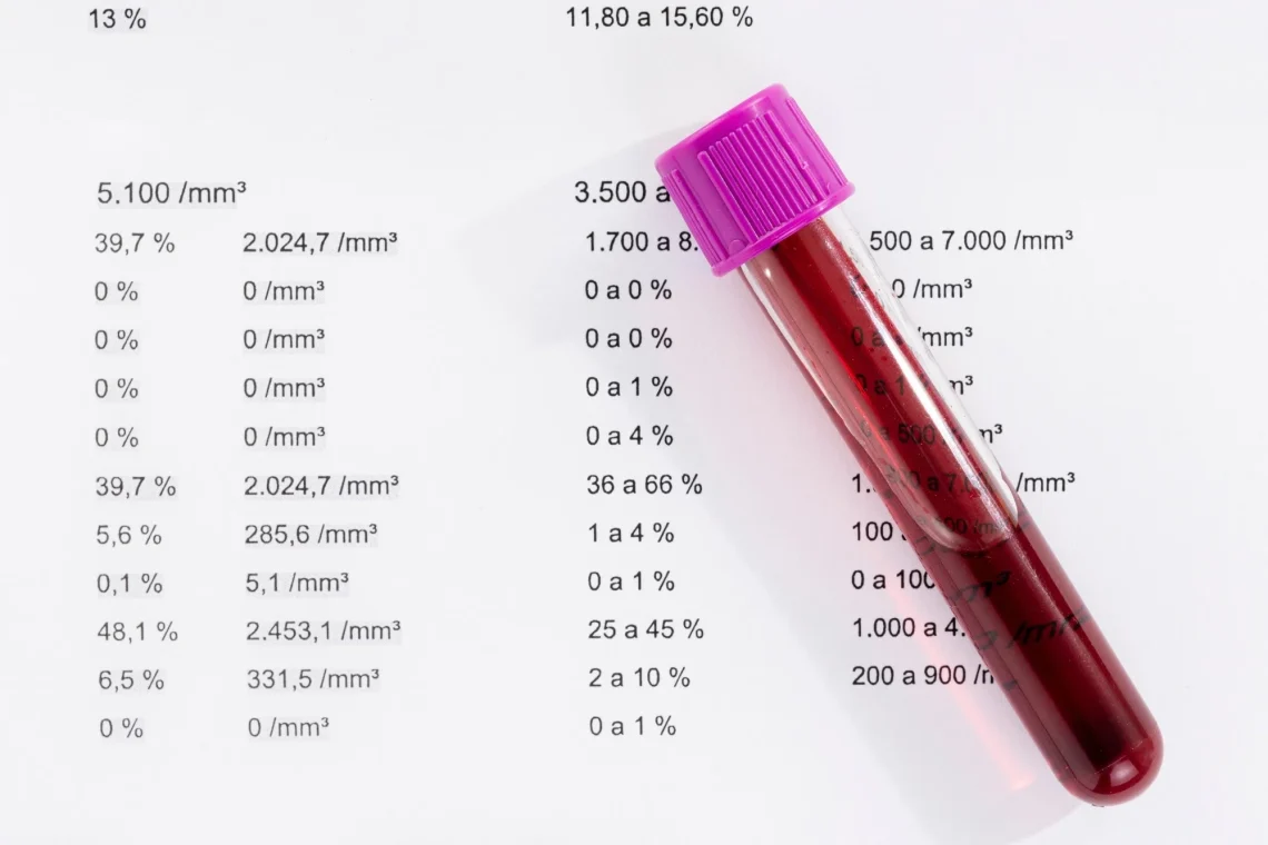 R74	Nivele jonormale të enzimave në serum (Gradus seroenzymarum abnormalis)